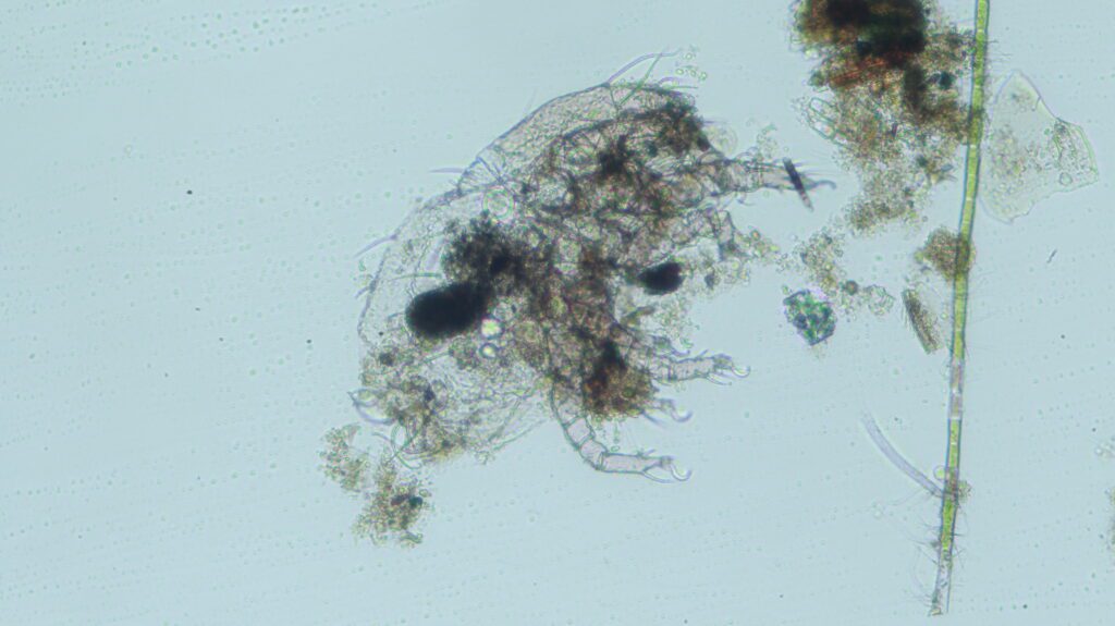 The Invisible Life of Microbes